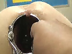 충격적인 항문 검경 벌어진 및 휘 스팅