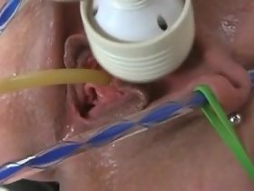 intercalate de Catheter mob elle-même